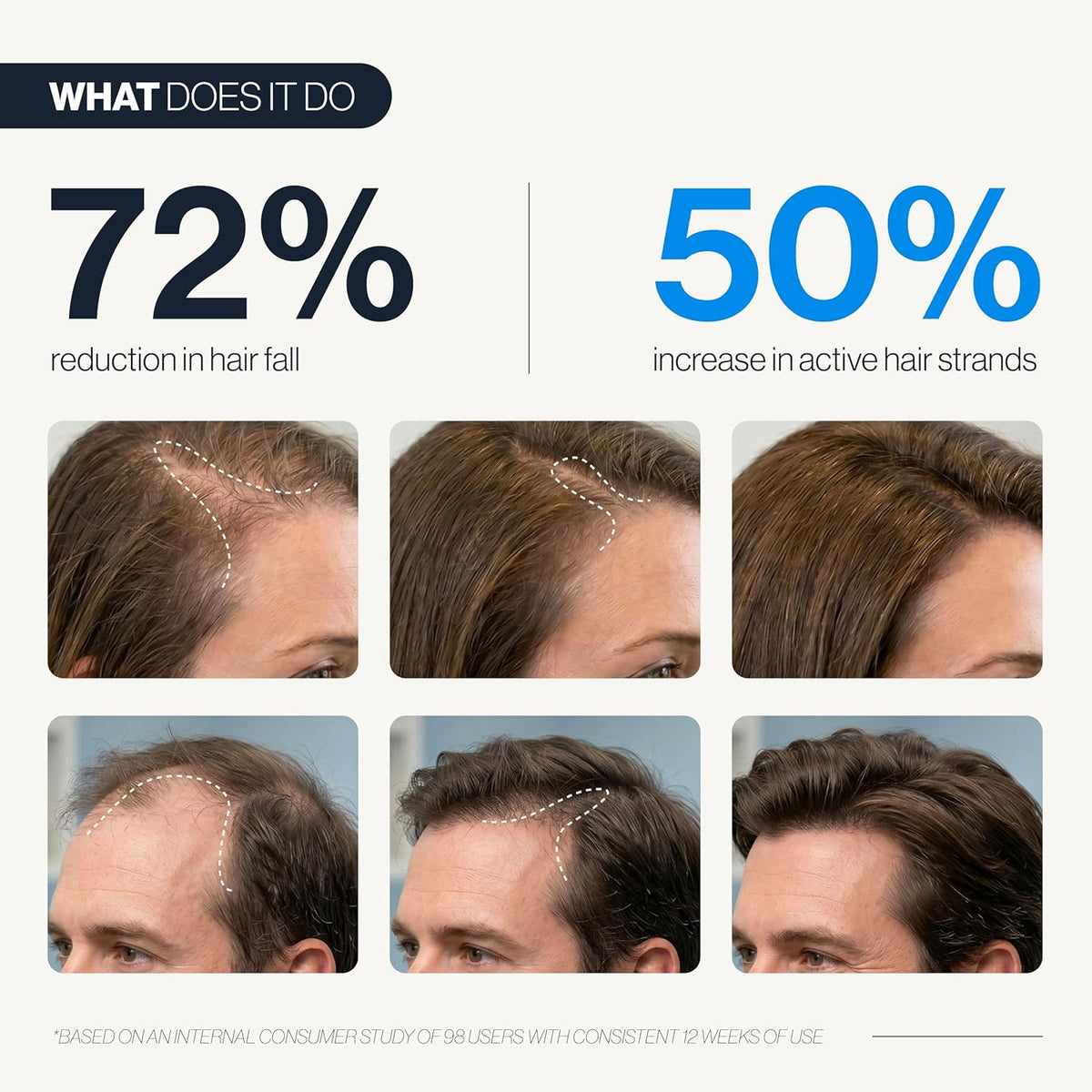 Follicle Boost Serum with Rosemary