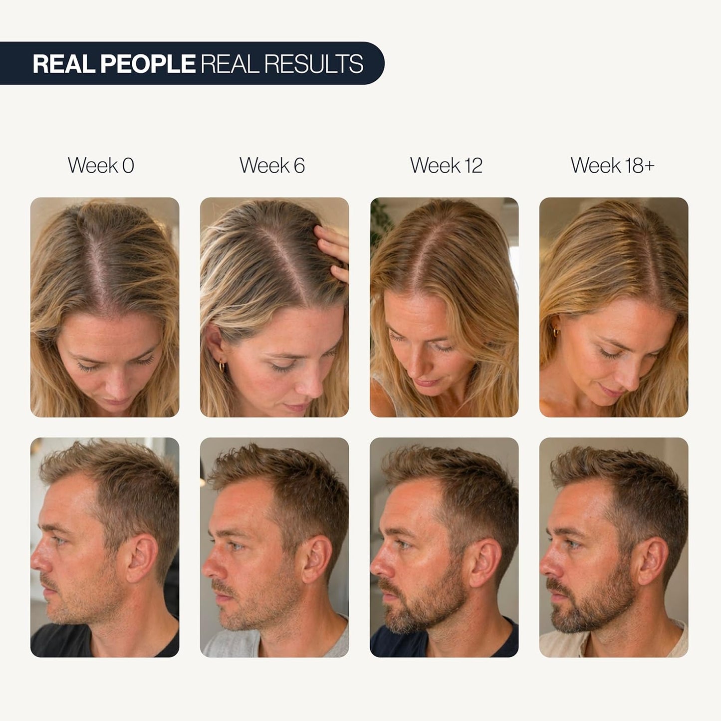 Follicle Boost Serum with Rosemary