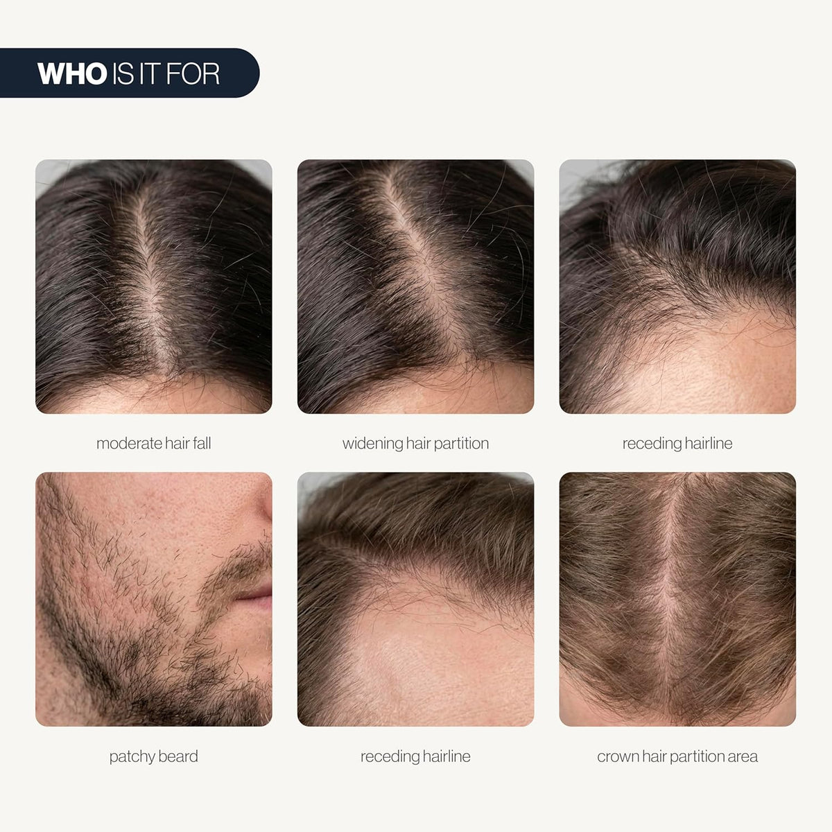 Follicle Boost Serum with Rosemary