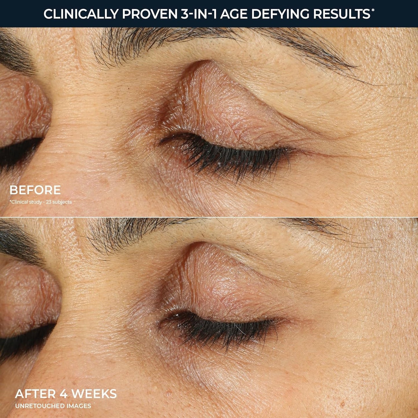 Retinol Eye Repair Cream for Dark Circles & Puffiness