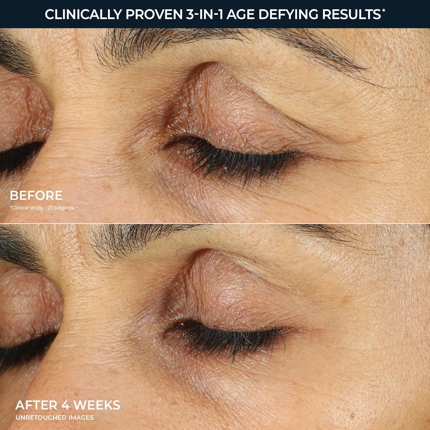 Retinol Eye Repair Cream for Dark Circles & Puffiness