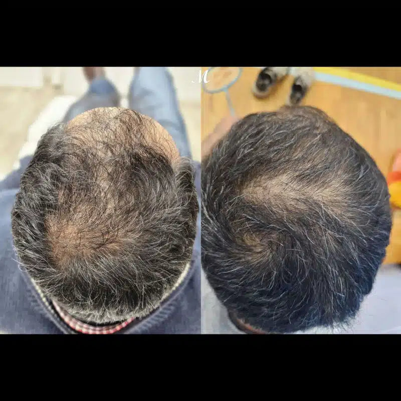 Korean Hair Recovery System™