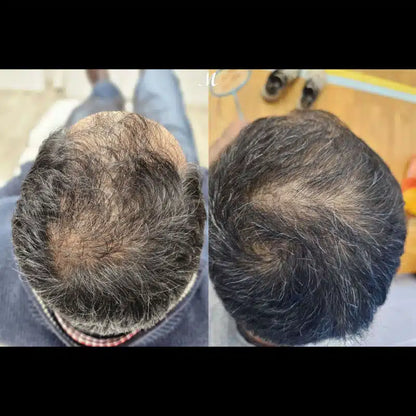 Korean Hair Recovery System™